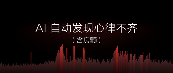 699元不加价！米动健康手环1S发布：AI自动发现心率不齐